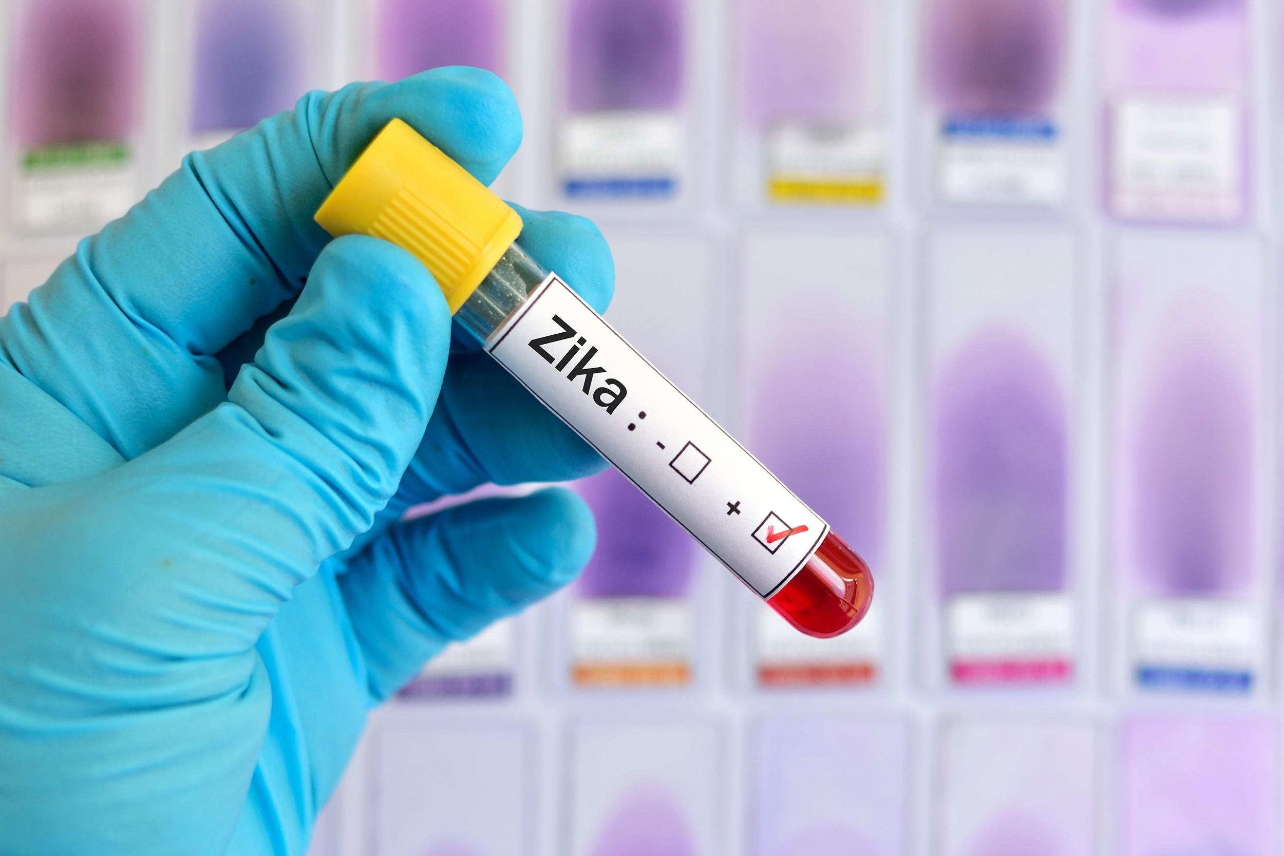 TAKE ZIKA SERIOUSLY