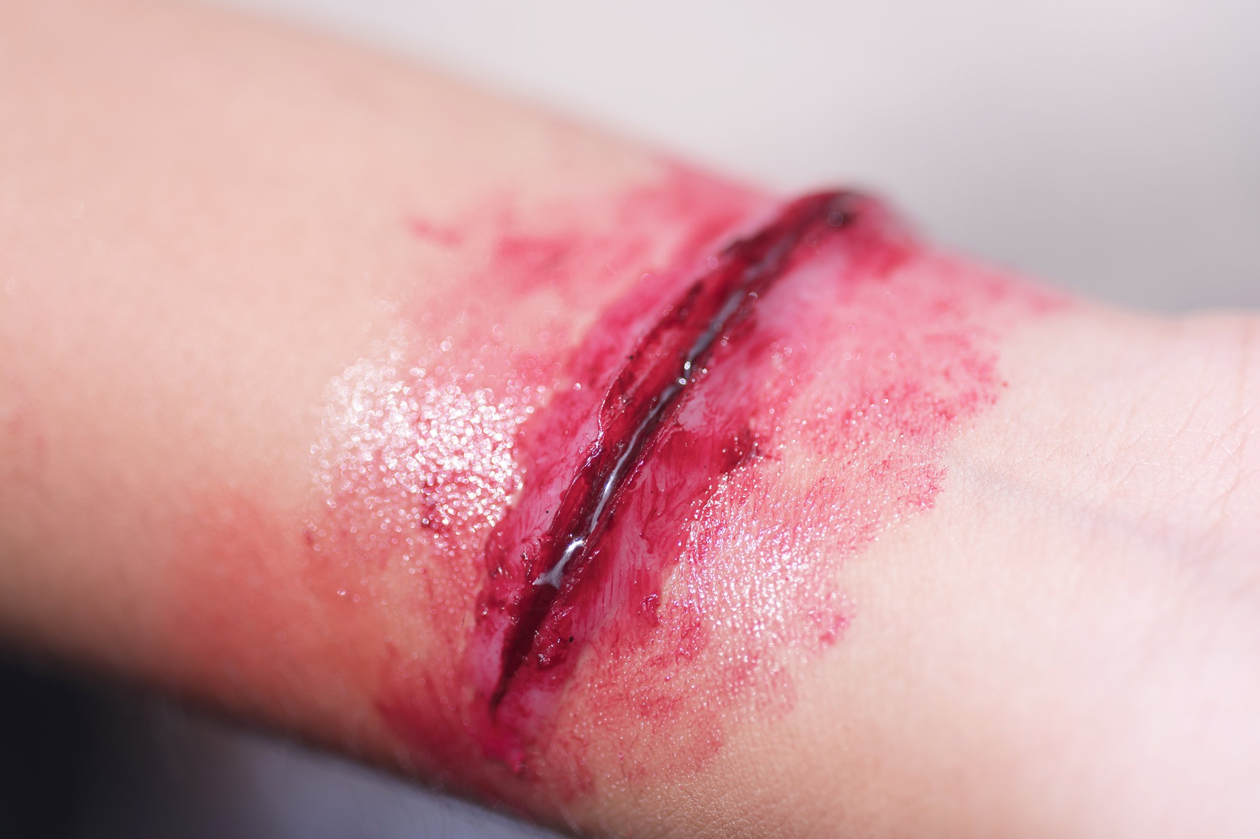 fake wound on wrist