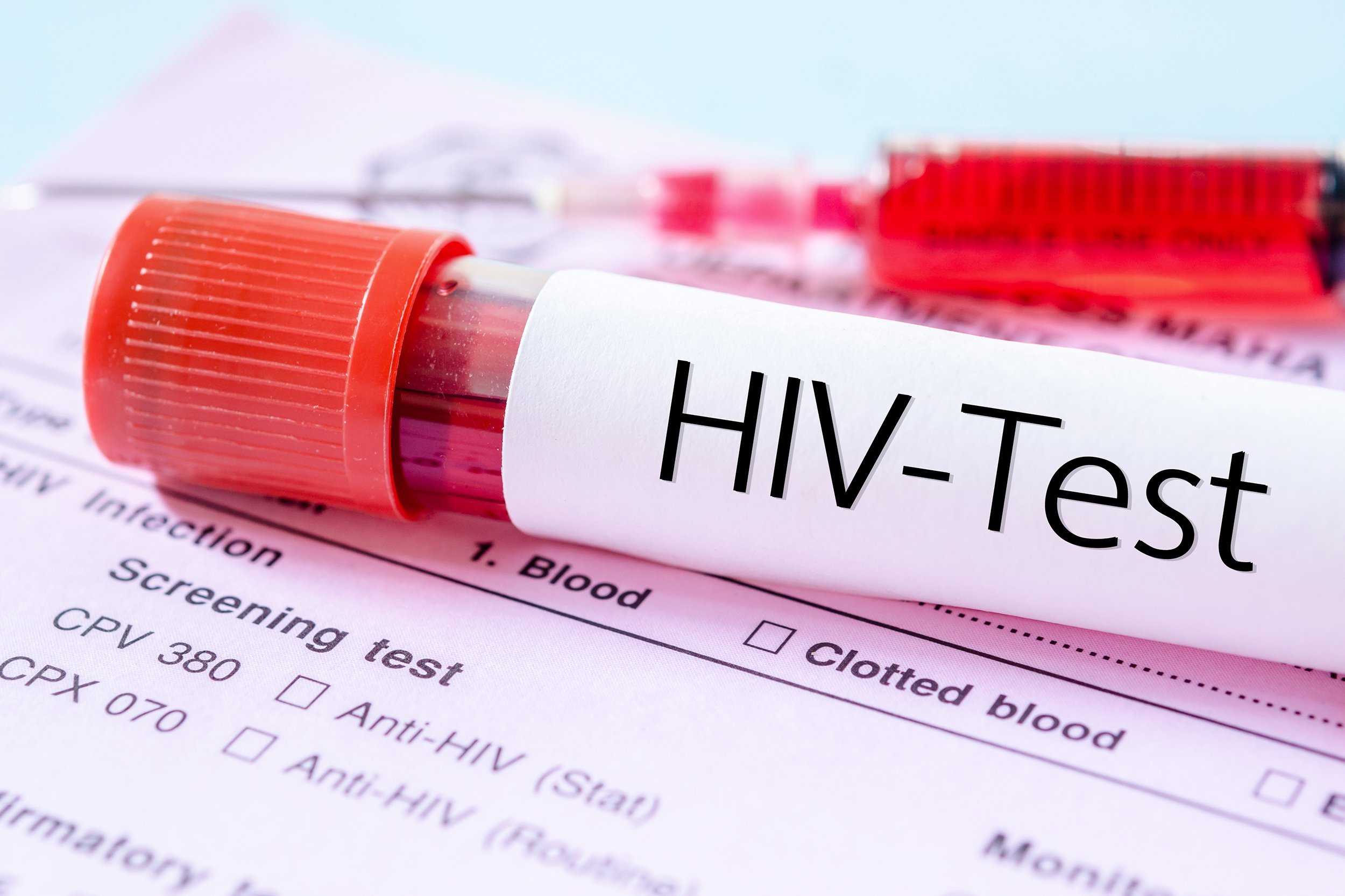 sample blood collection tube with HIV test label on HIV infection screening test form