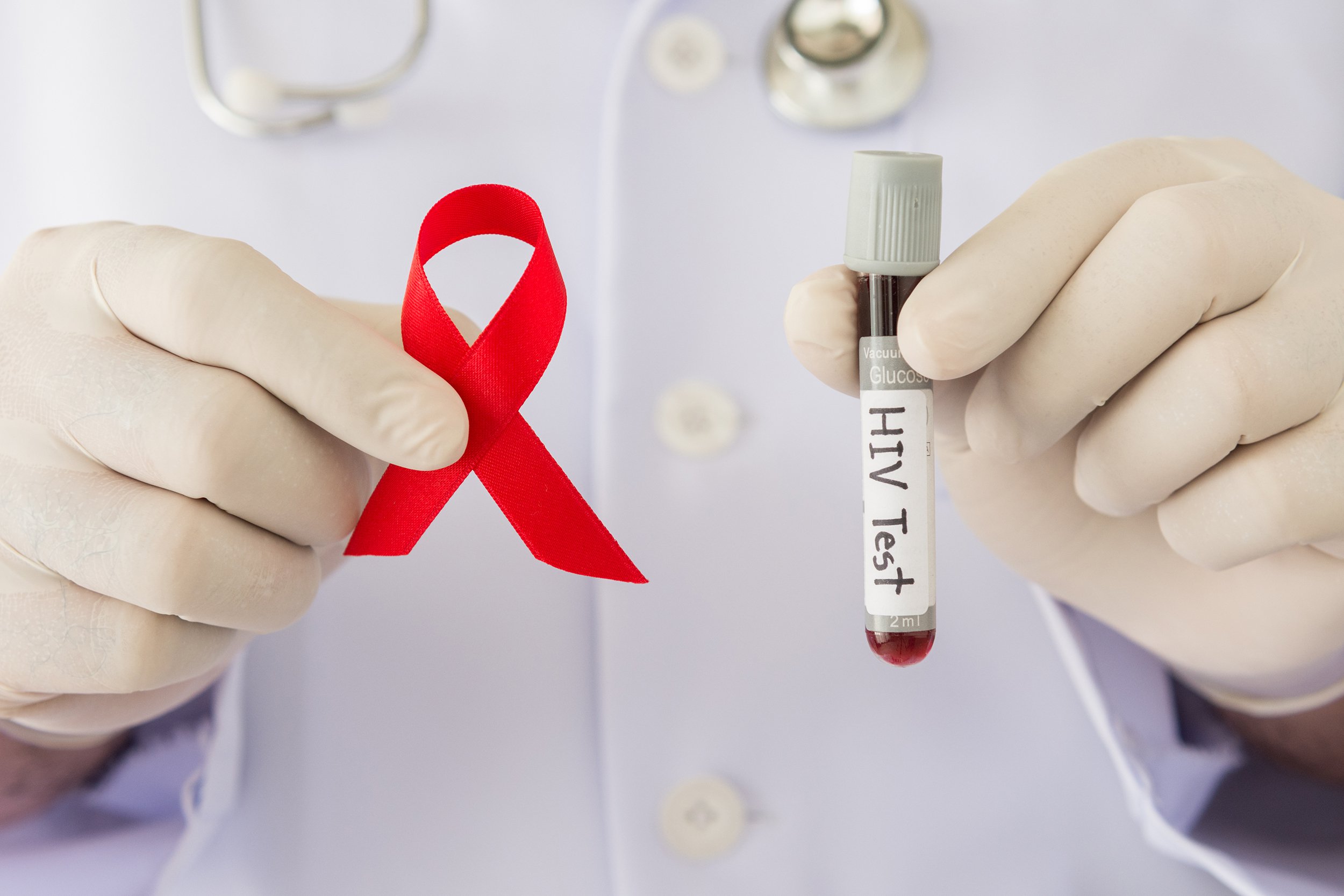 Closeup of doctor holding a red ribbon and vile of blood for an Aids test