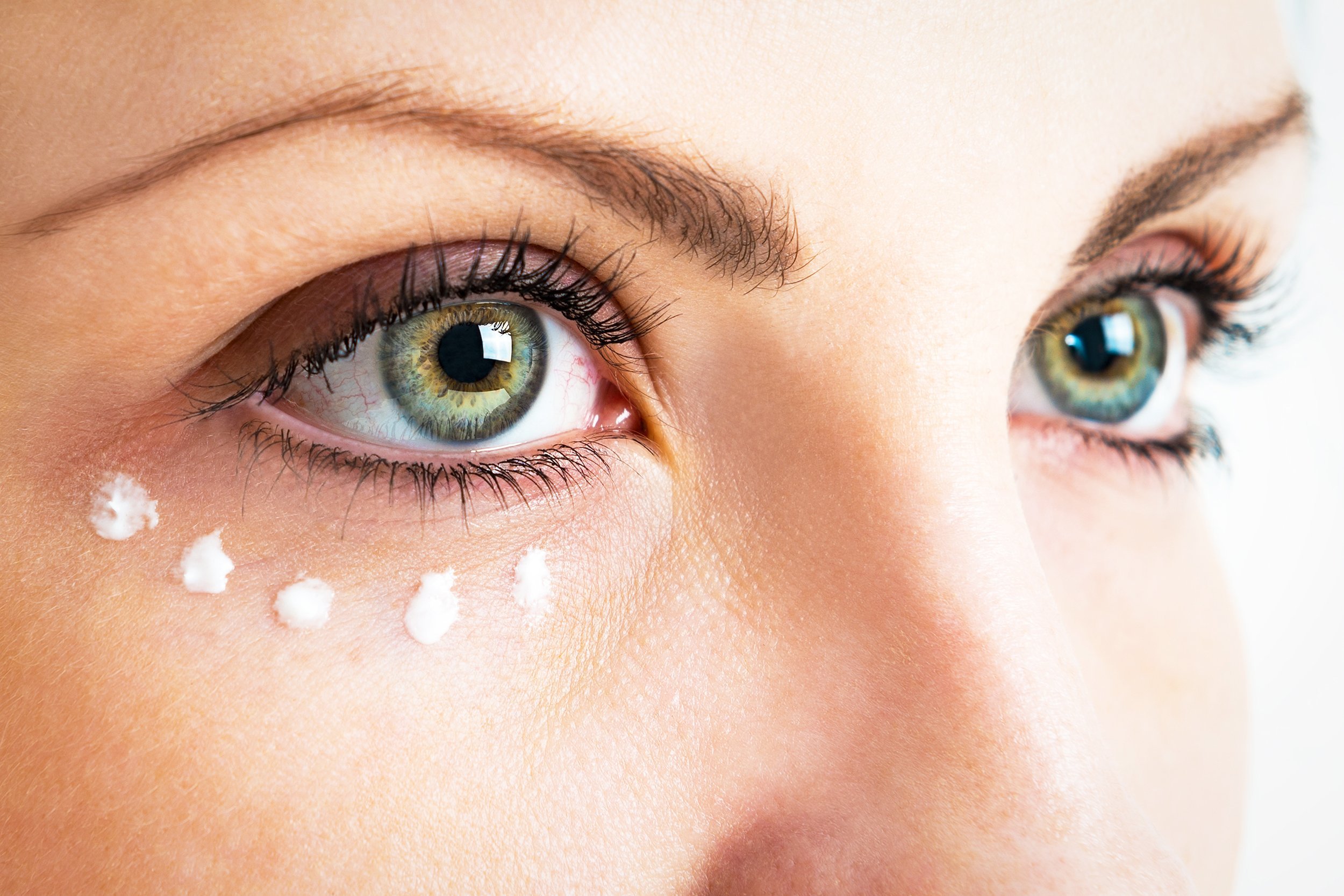 dots of eye cream around the eyes