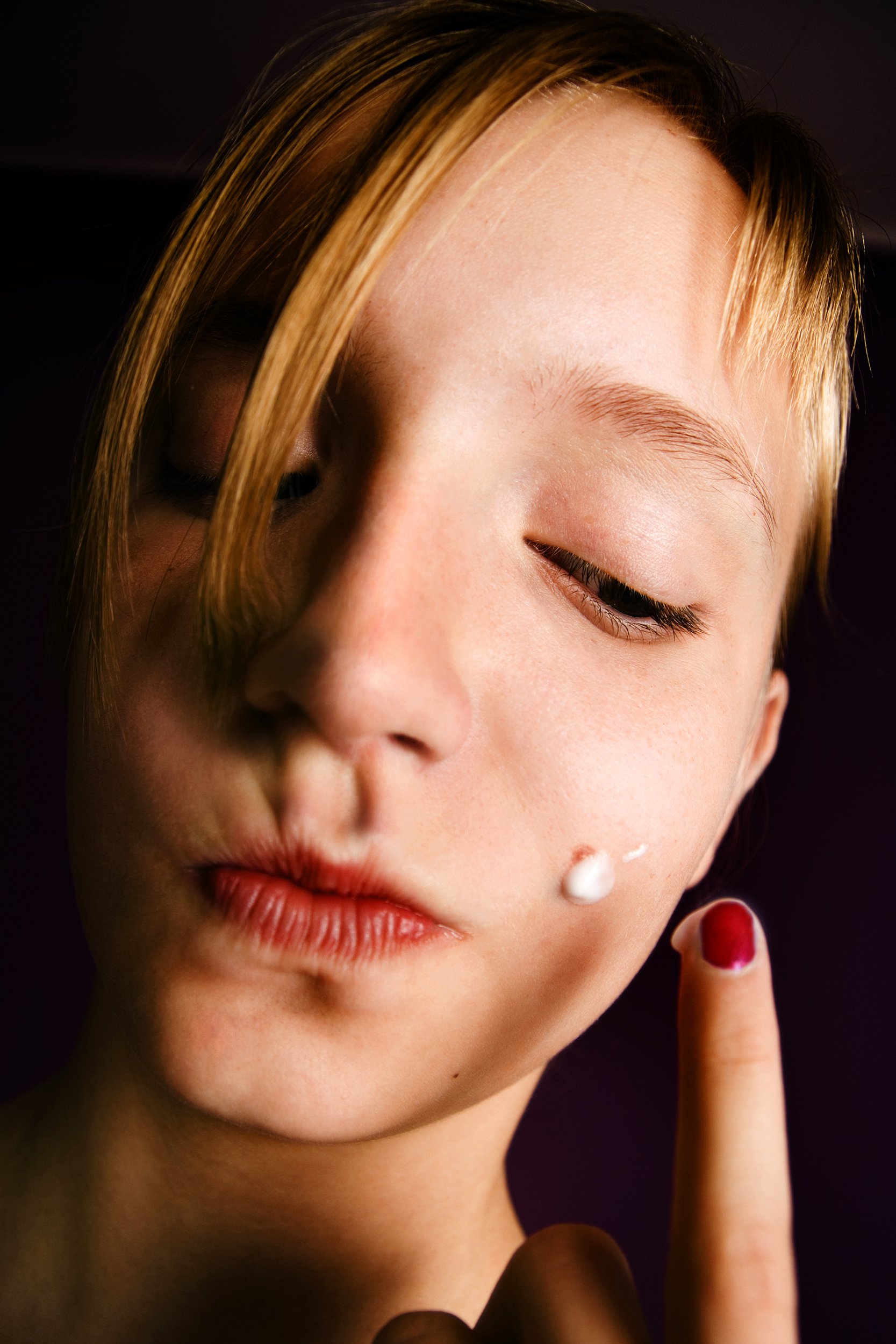 teenage girl putting acne medication on pimple