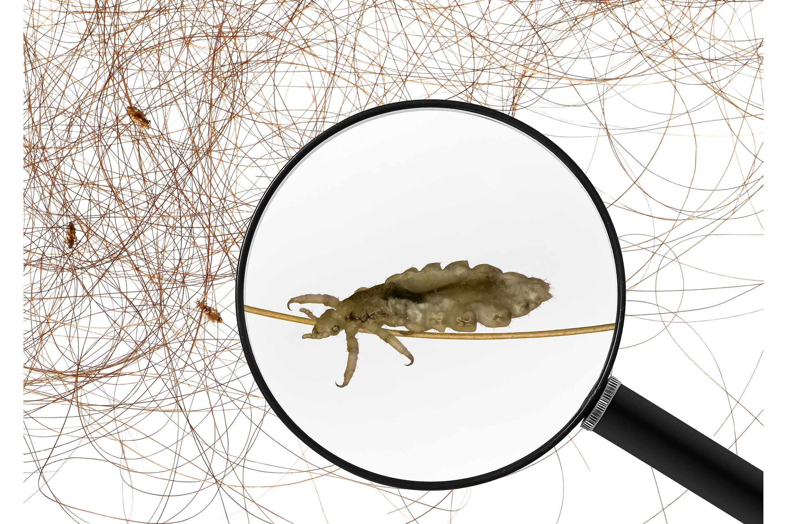 Magnifying glass focusing on lice with lice and hair in the background
