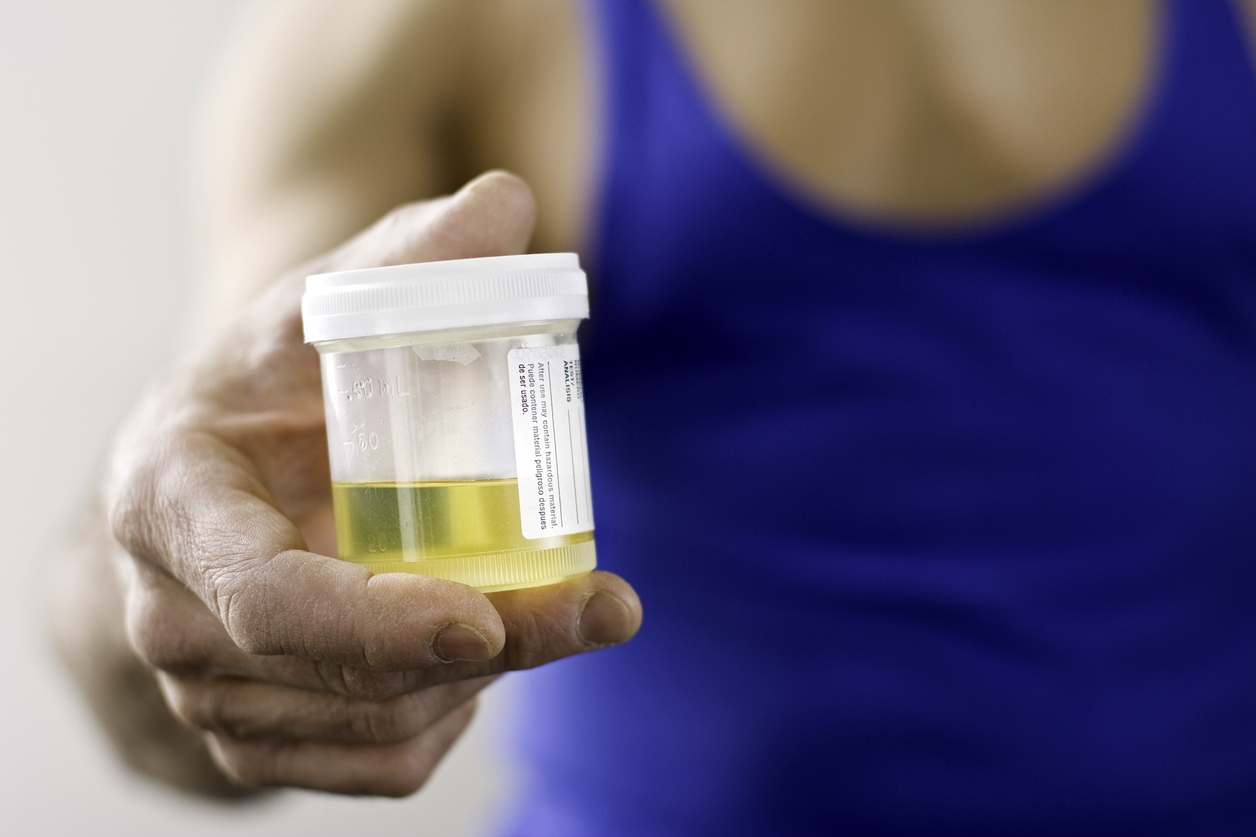 Urine sample