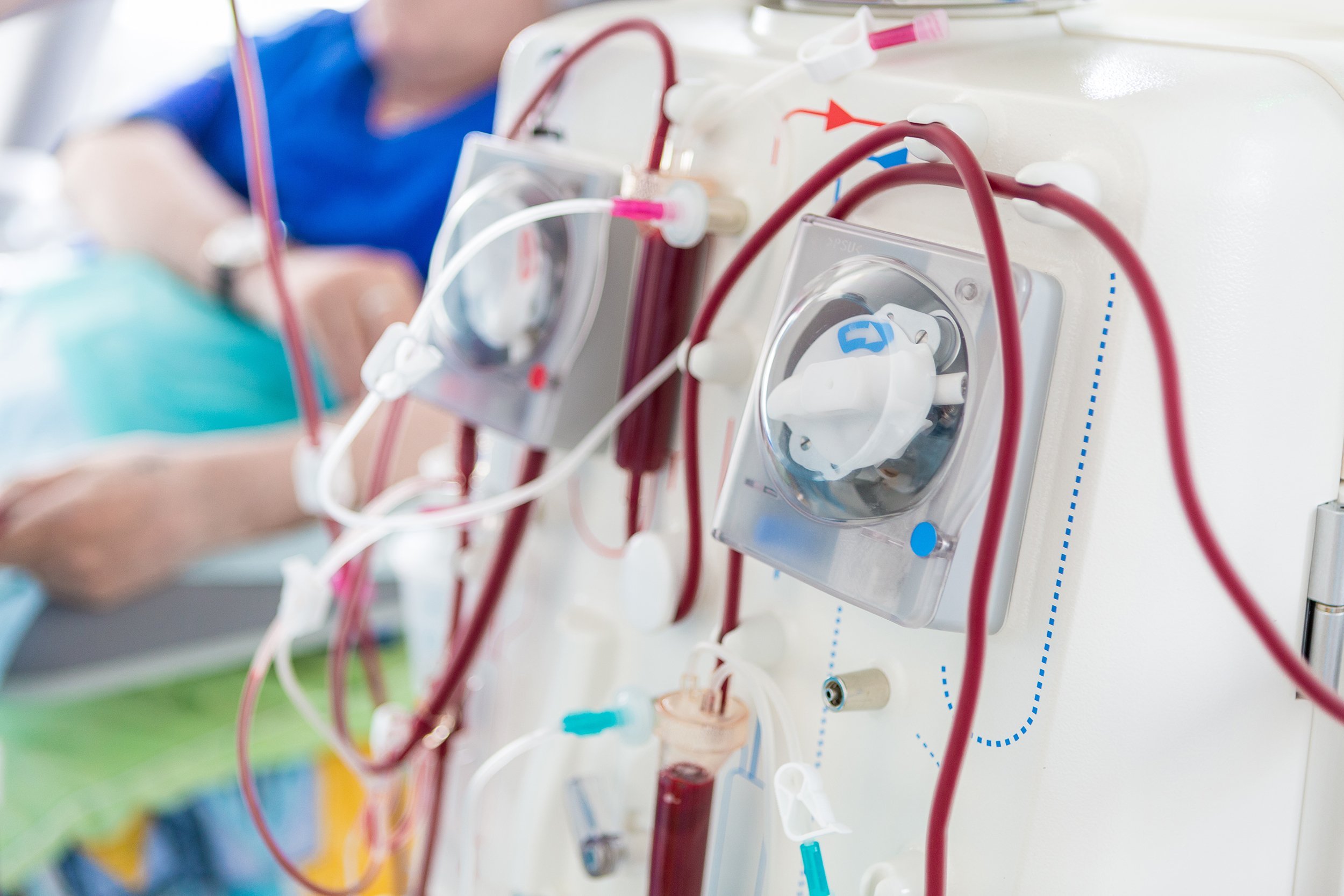 dialysis system in hospital