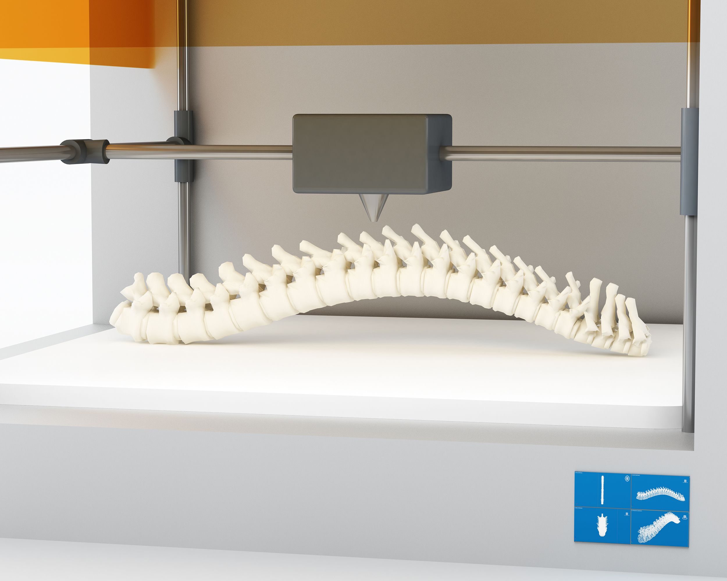 3D printed spine in 3D printer