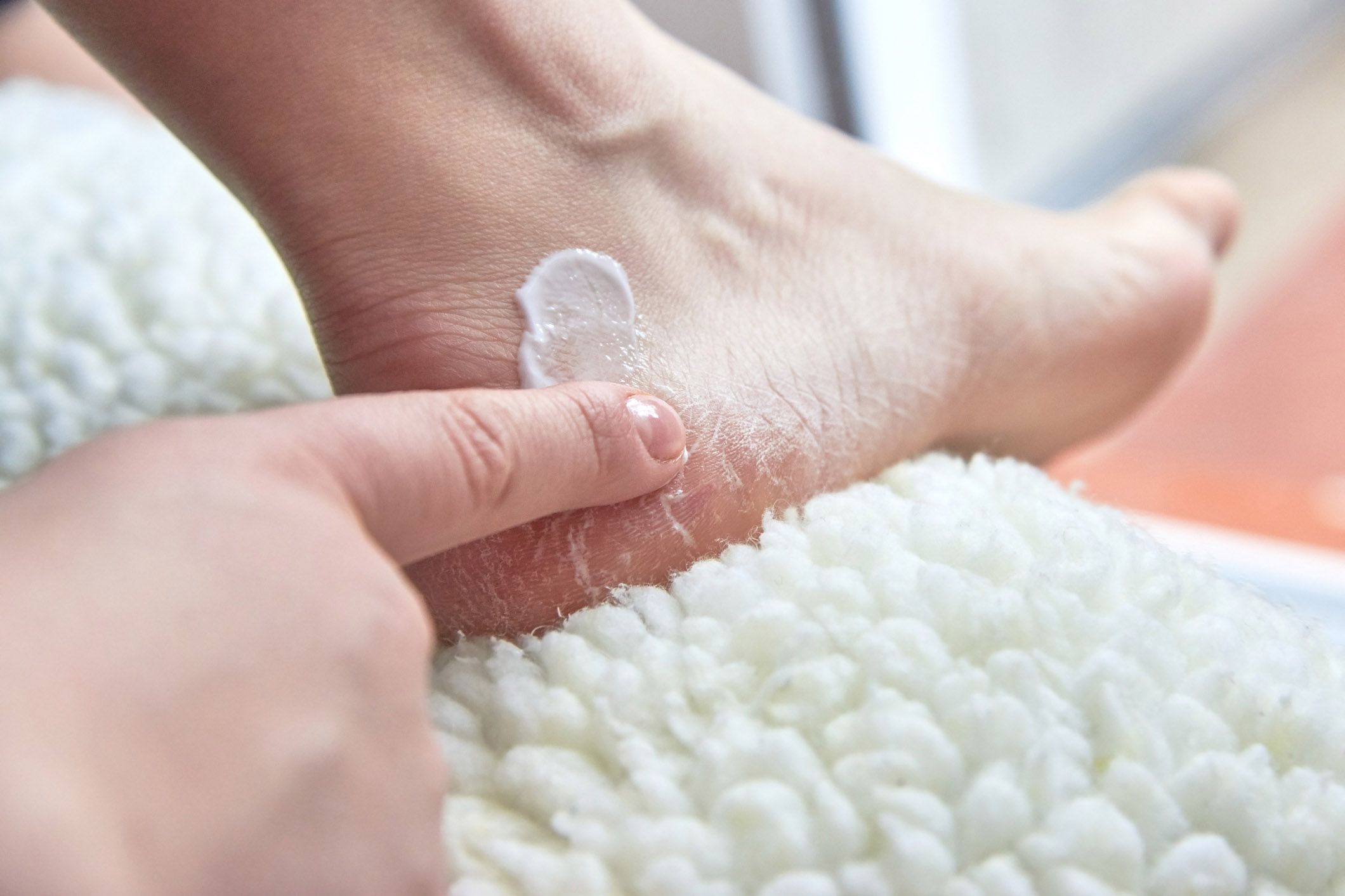 hand applying cream to foot