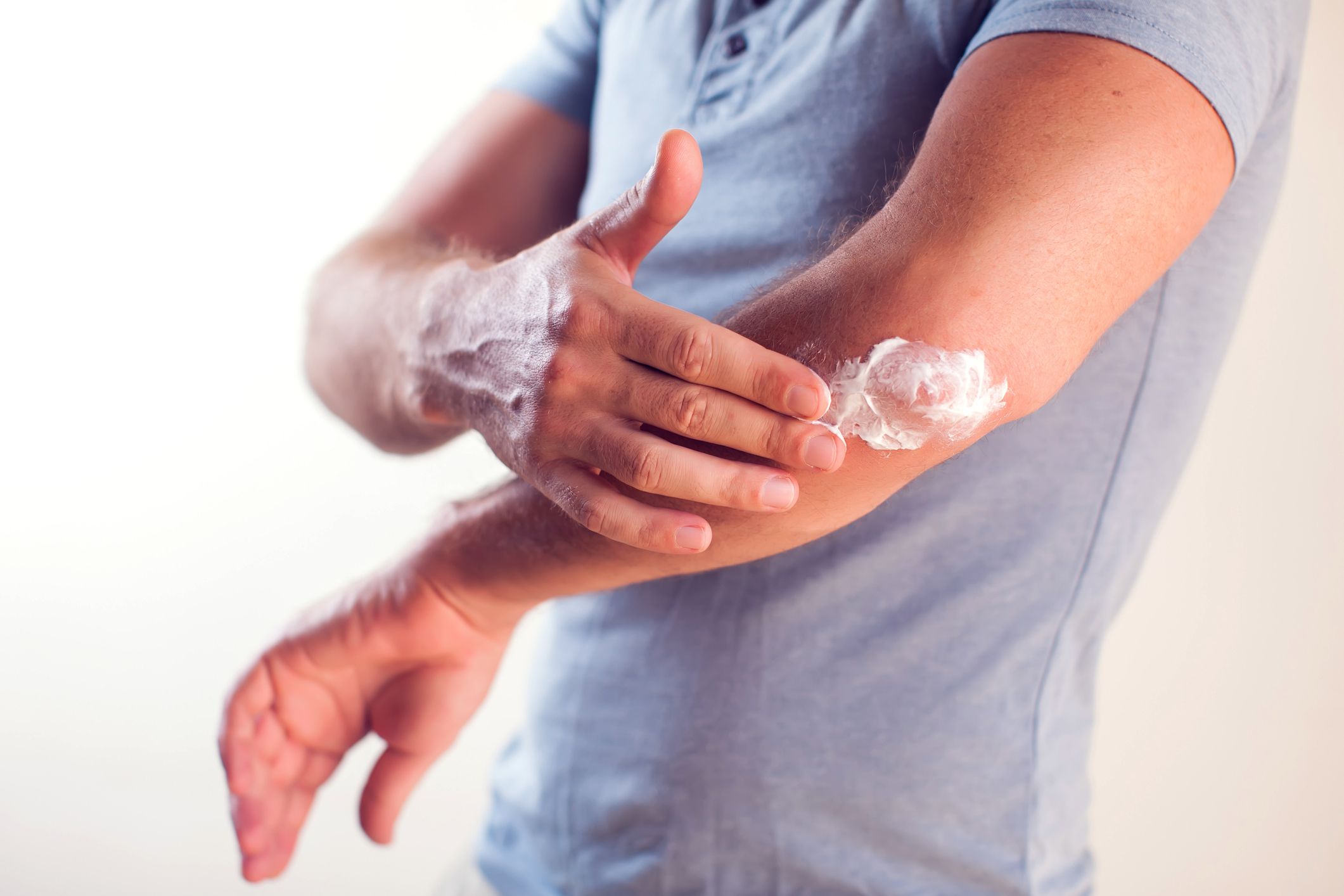 man applying cream to arm and elbow