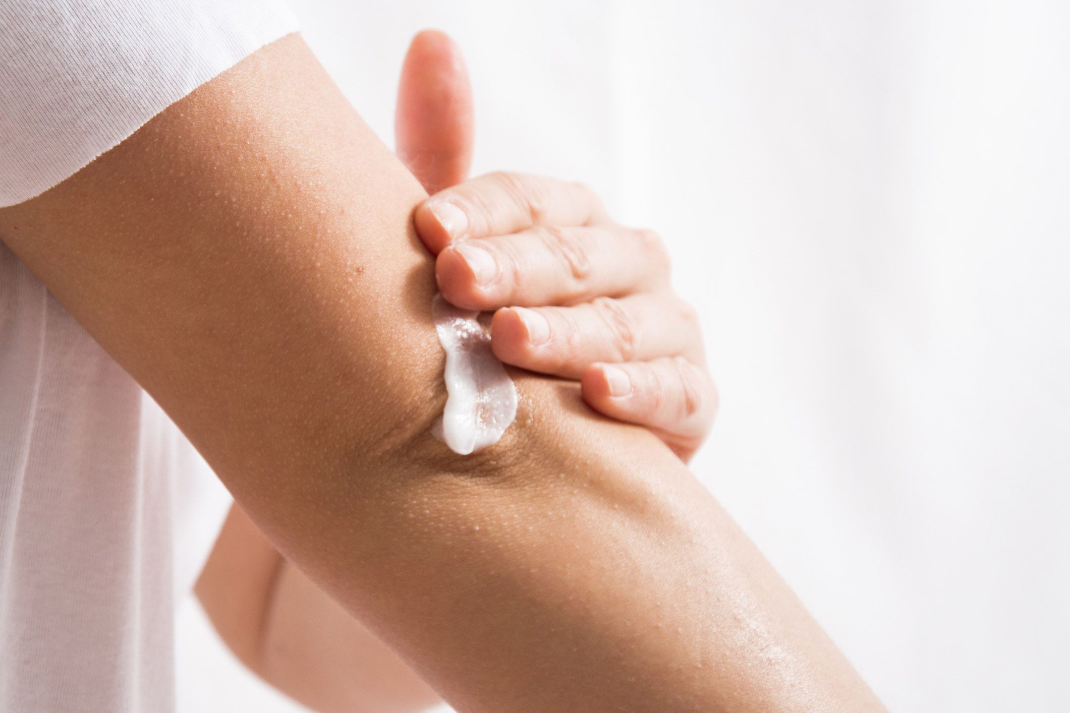hand applying cream to elbow