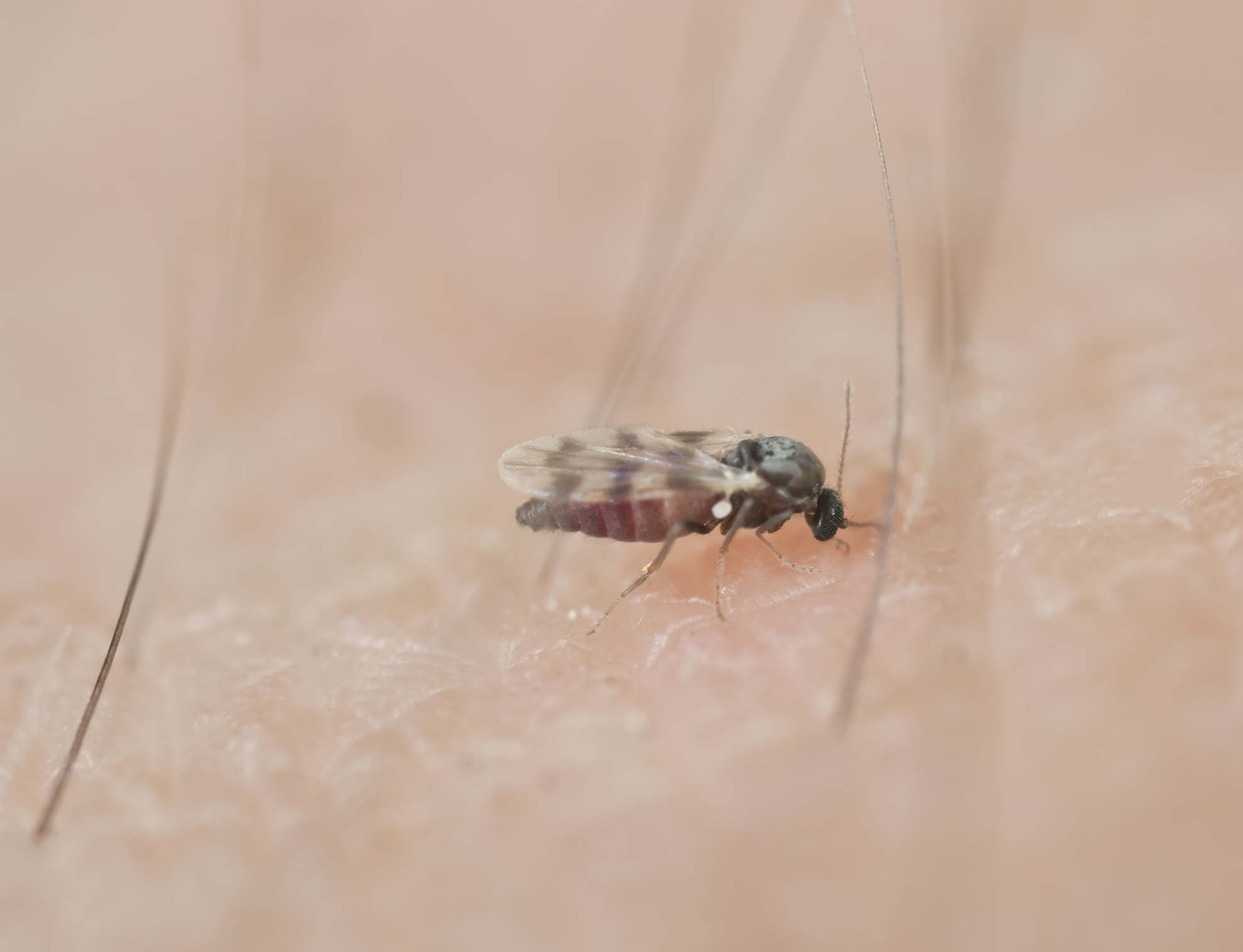 Extreme closeup of a black fly sucking blood on a Caucasian human arm with intervals of dark brown hair