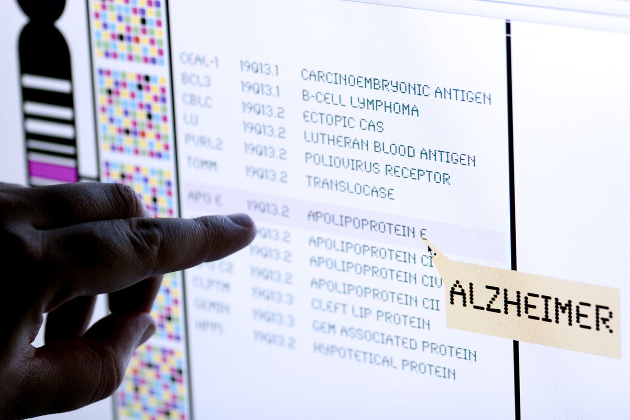 hand pointing at word alzheimer on screen