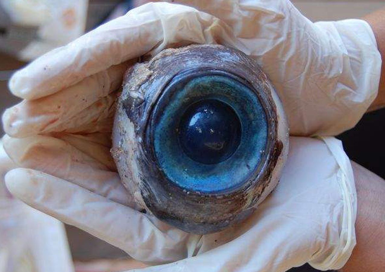 Giant Eyeball