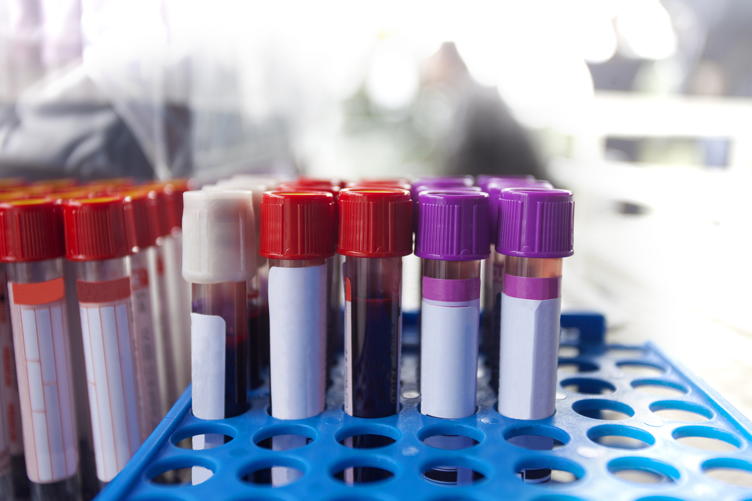 Blood samples