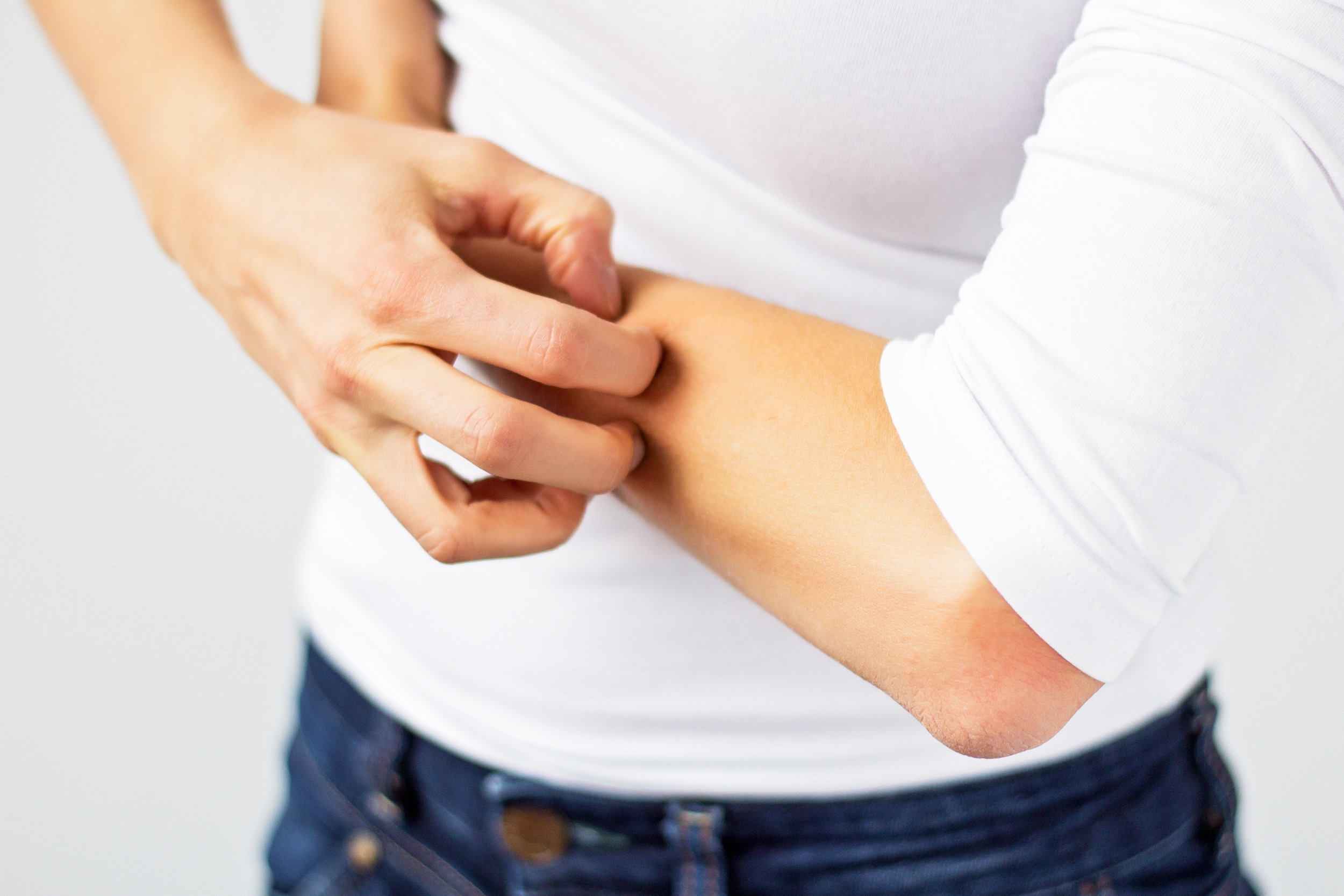 woman scratching her arm