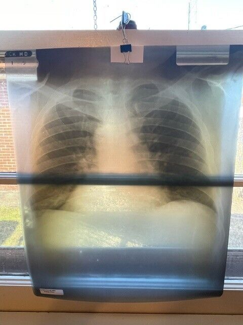 chest xray from the 60s on ebay
