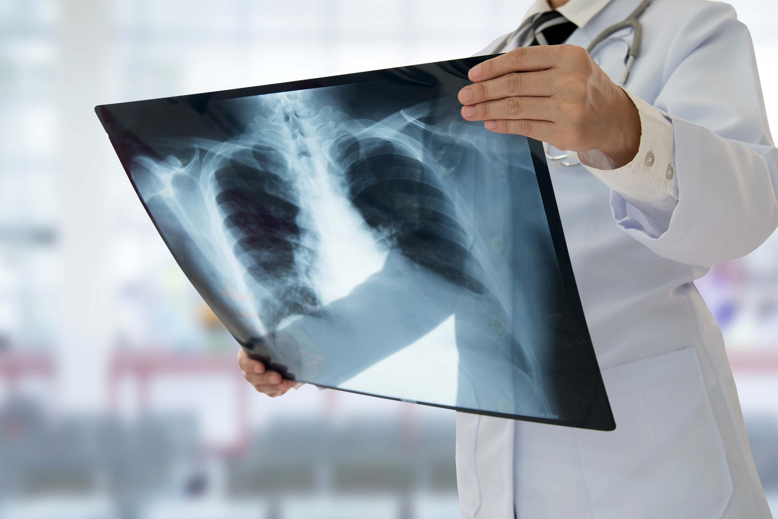 Radiologist examining an X-ray