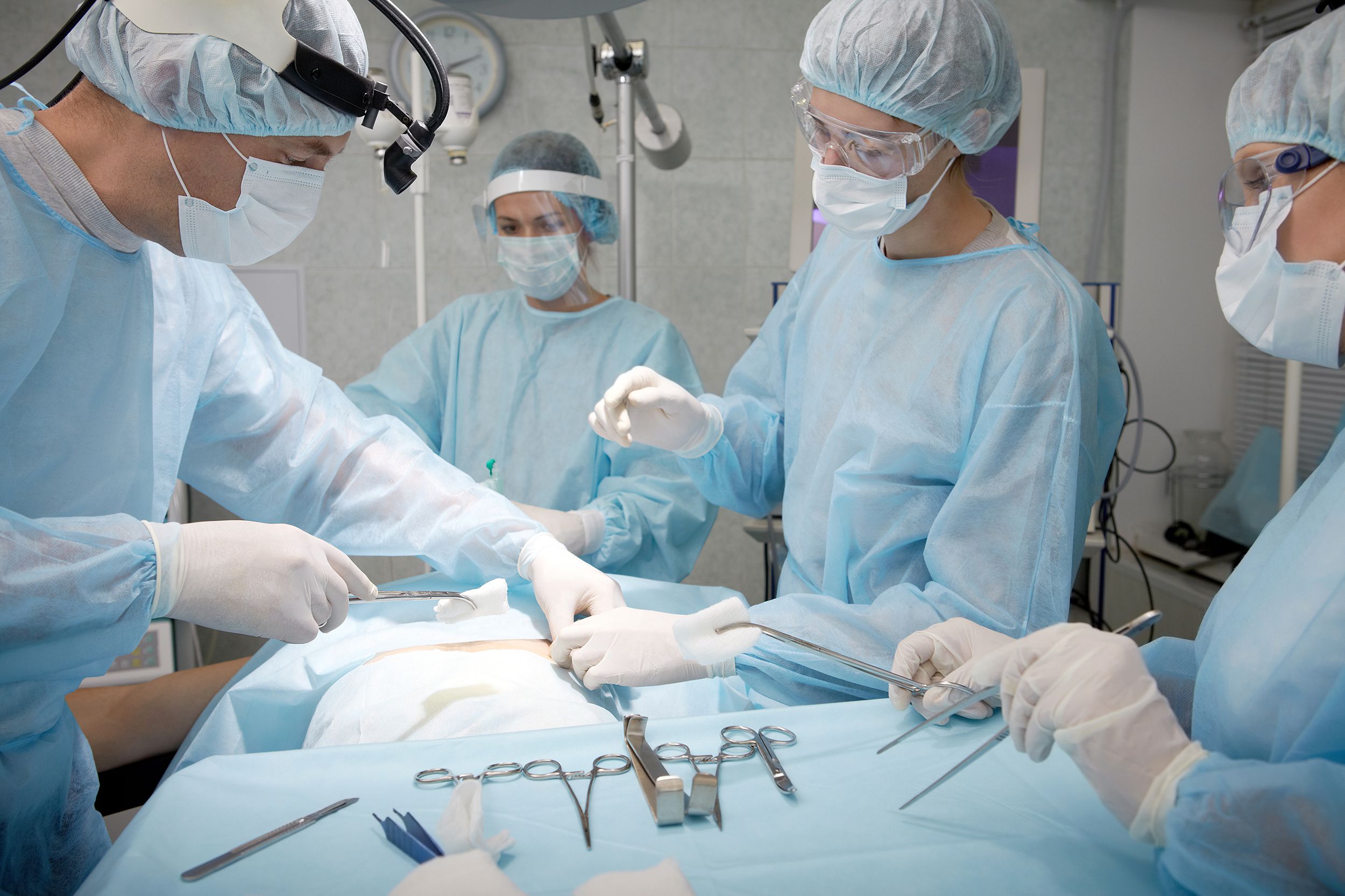 Four surgeons doing a surgery on a patient in the operating room, a row of surgical instruments and scissors lined in the foreground, they are surrounding the patient, lots of light blue
