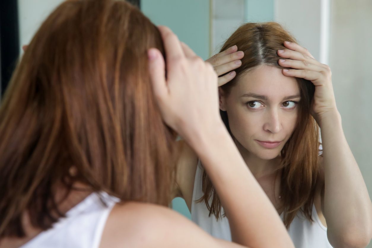 female hair loss