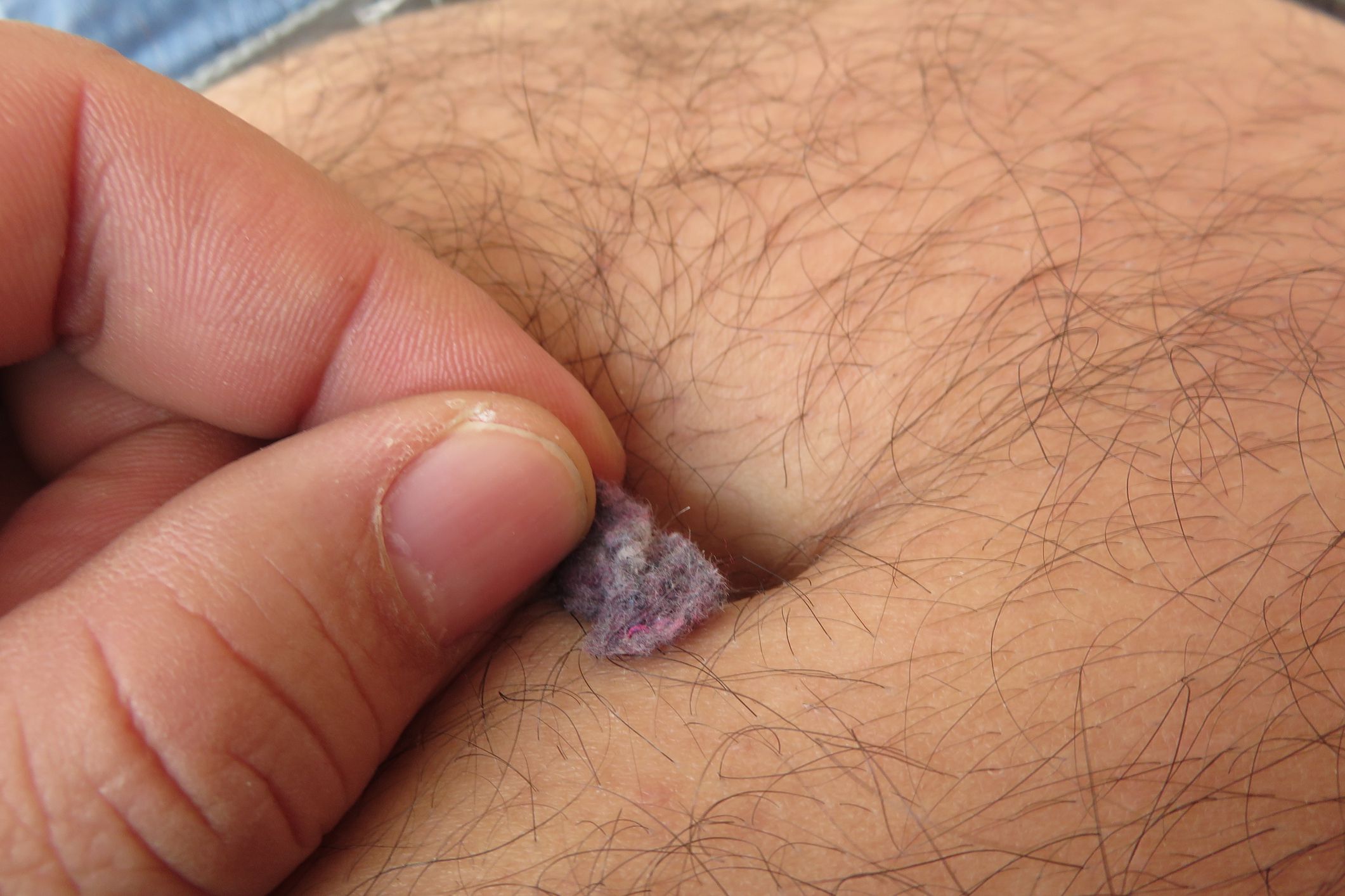 Lint in belly button