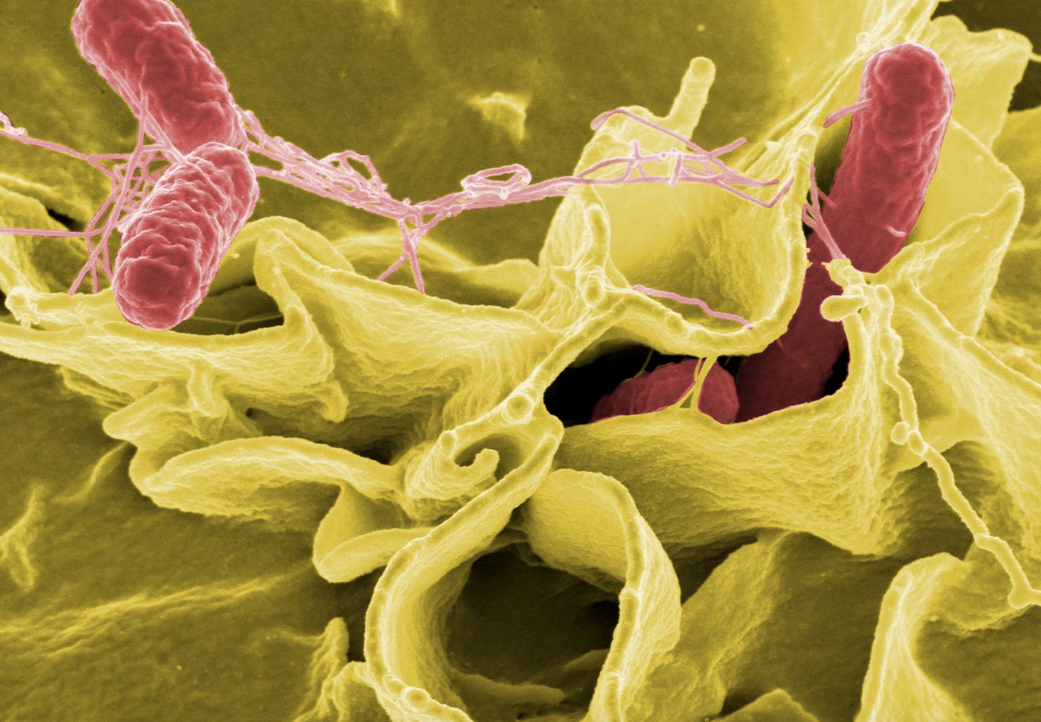 Salmonella bacteria