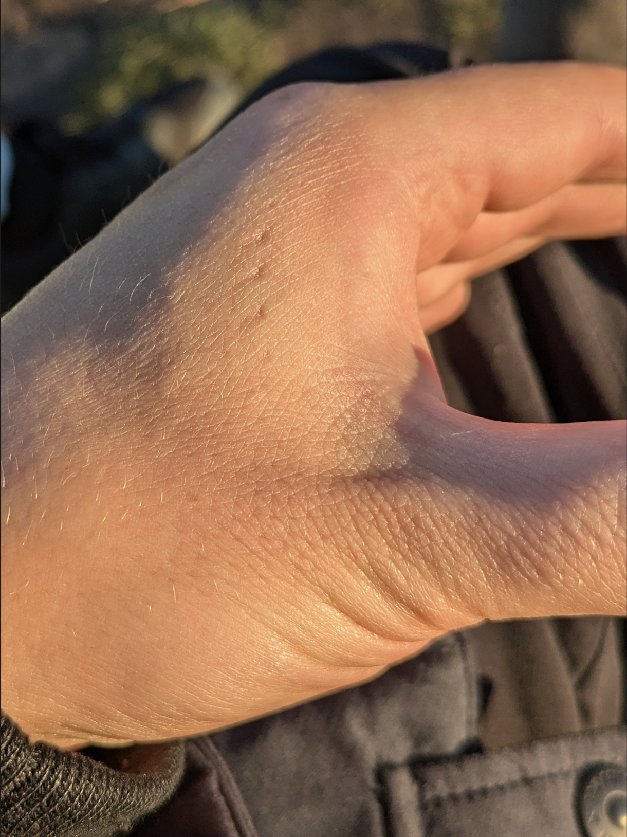 A close-up of a hand in sunlight, showing fine hairs, skin texture, and small scars. The background is blurred, with hints of dark clothing visible.
