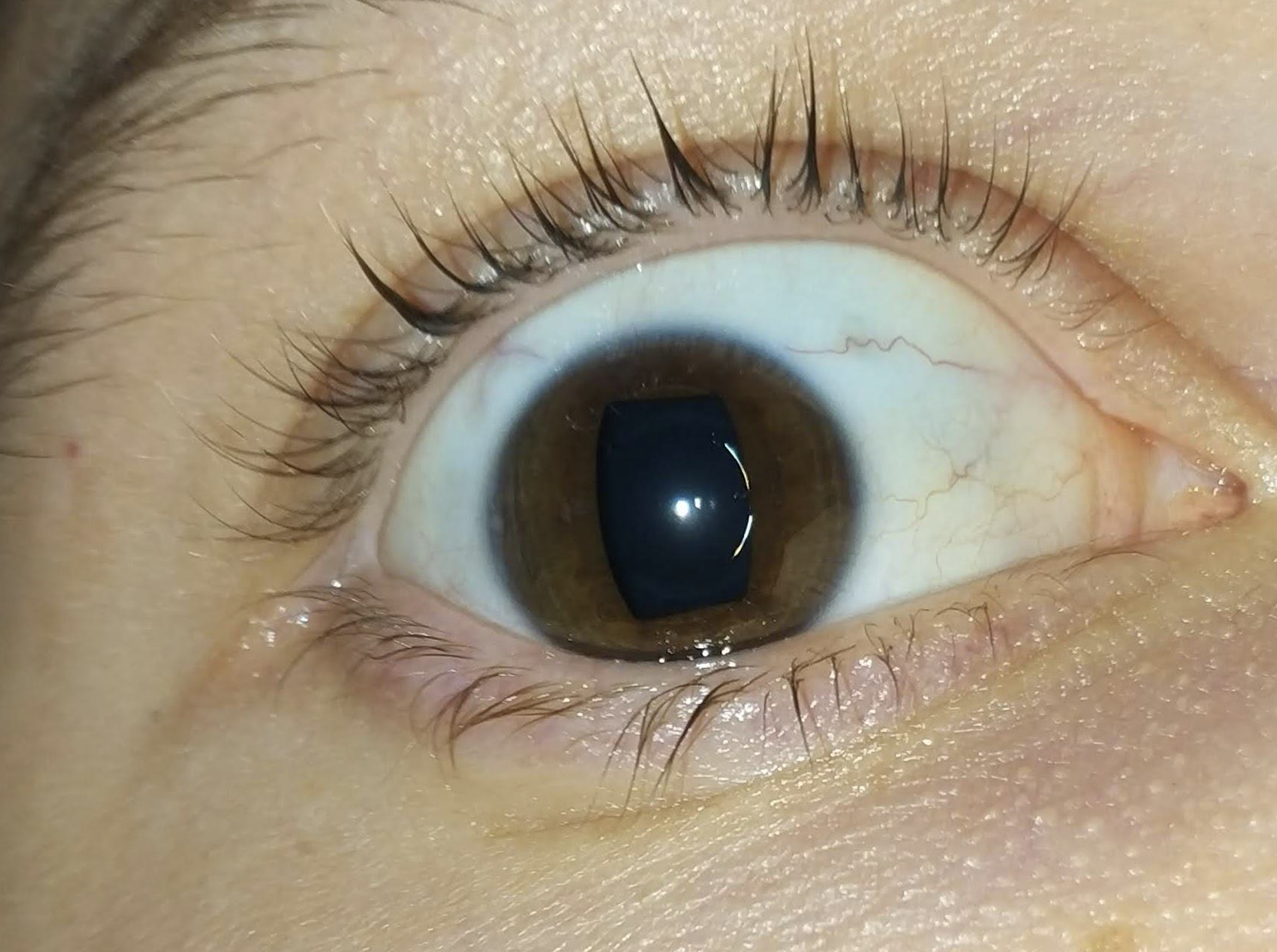 A close-up photo of a human eye with a dilated pupil and brown iris, showing detailed eyelashes and some blood vessels in the white of the eye.